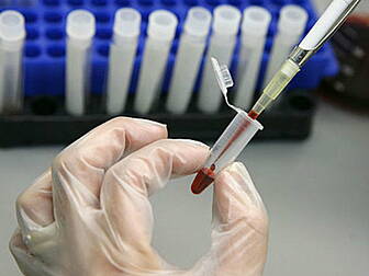 HIV rate not falling fast enou...